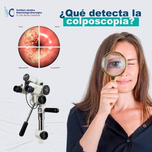 Qué detecta la colposcopia